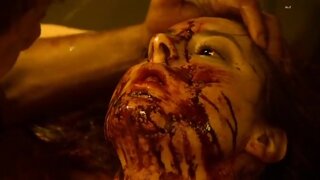 Eva Amurri Nude and hurt in Animals